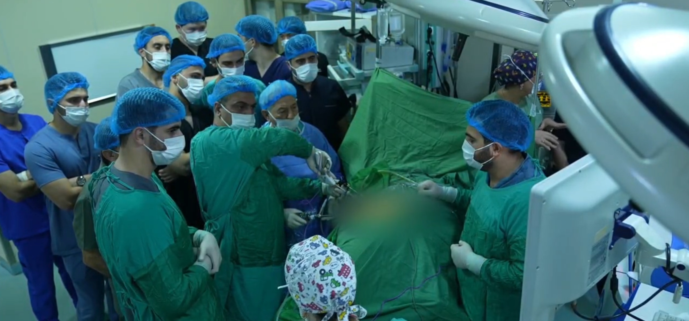 Səhiyyə Nazirliyinin klinikasında 7,5 sm-lik böyrəküstü vəz törəməsi laparoskopik üsulla çıxarılıb